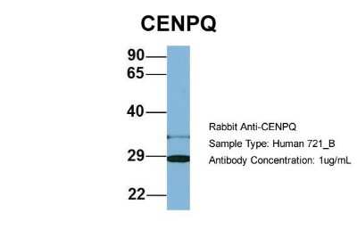 Western Blot: CENPQ Antibody [NBP1-55216]