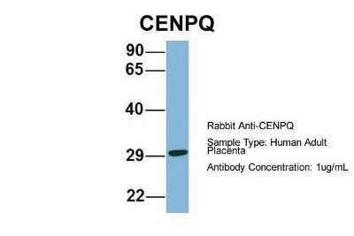 Western Blot: CENPQ Antibody [NBP1-55216]