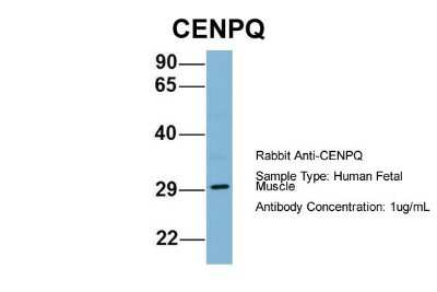 Western Blot: CENPQ Antibody [NBP1-55216]