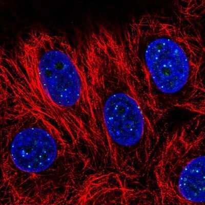 Immunocytochemistry/ Immunofluorescence: CENPT Antibody [NBP2-34093]