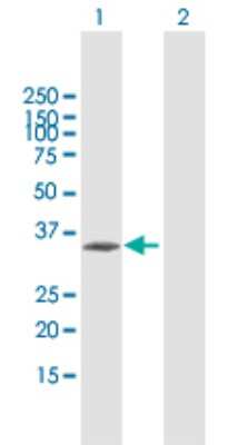 Western Blot: CENPT Antibody [H00080152-B01P]