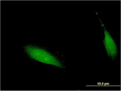 Immunocytochemistry/ Immunofluorescence: CENPV Antibody (1D9) [H00201161-M05]