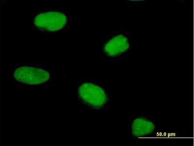 Immunocytochemistry/ Immunofluorescence: CENPV Antibody [H00201161-B01P]
