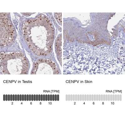 Immunohistochemistry-Paraffin: CENPV Antibody [NBP1-84546]