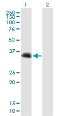 Western Blot: CENPV Antibody [H00201161-B01P]