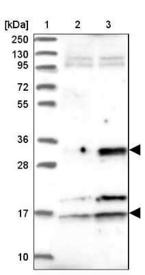 Western Blot: CENPV Antibody [NBP1-84546]