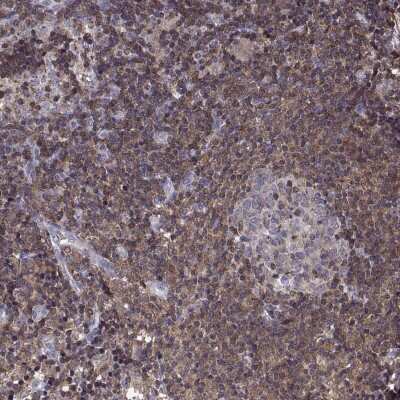 Immunohistochemistry-Paraffin: CENTB1 Antibody [NBP2-69009]