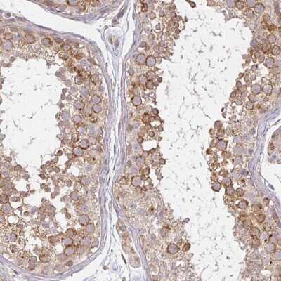 Immunohistochemistry-Paraffin: CEP110 Antibody [NBP2-48546]