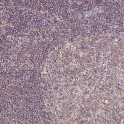 Immunohistochemistry-Paraffin: CEP110 Antibody [NBP2-48546]