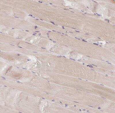 Immunohistochemistry-Paraffin: CEP110 Antibody [NBP2-48546]