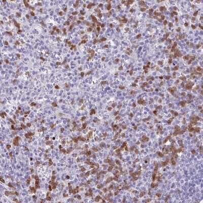 Immunohistochemistry: CEP120 Antibody [NBP2-49011]