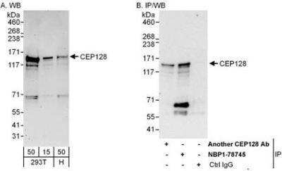 Western Blot: CEP128 Antibody [NBP1-78745]