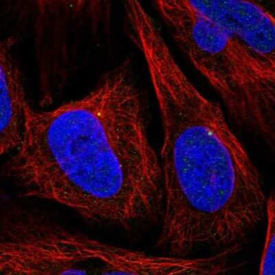 Immunocytochemistry/ Immunofluorescence: CEP164 Antibody [NBP1-81445]