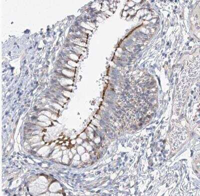 Immunohistochemistry-Paraffin: CEP164 Antibody [NBP1-81445]