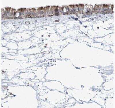 Immunohistochemistry-Paraffin: CEP164 Antibody [NBP1-81445]