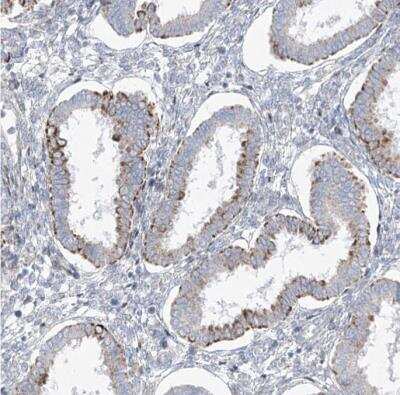 Immunohistochemistry-Paraffin: CEP164 Antibody [NBP1-81445]