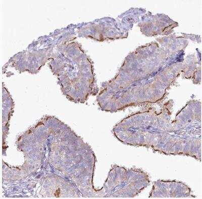 Immunohistochemistry-Paraffin: CEP164 Antibody [NBP1-81445]