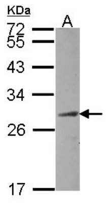 Western Blot: CEP27 Antibody [NBP2-15861]
