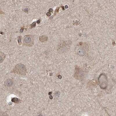 Immunohistochemistry-Paraffin: CEP350 Antibody [NBP1-86638]