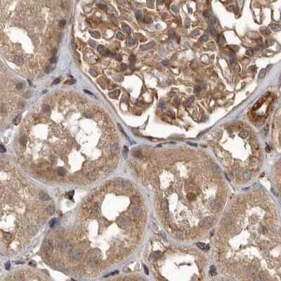 Immunohistochemistry-Paraffin: CEP350 Antibody [NBP1-86638]