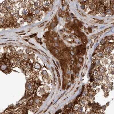 Immunohistochemistry-Paraffin: CEP350 Antibody [NBP1-86638]