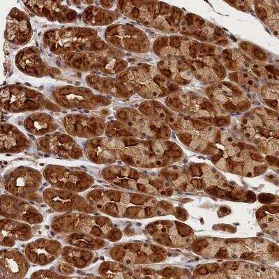 Immunohistochemistry: CEP44 Antibody [NBP1-90640]