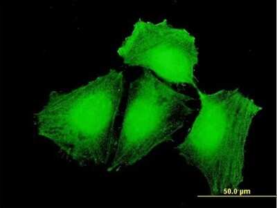 Immunocytochemistry/ Immunofluorescence: CEP57 Antibody [H00009702-B01P]
