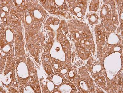 Immunohistochemistry-Paraffin: CEP57 Antibody [NBP2-15863]