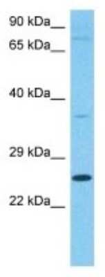Western Blot: CEP57 Antibody [NBP3-10691]