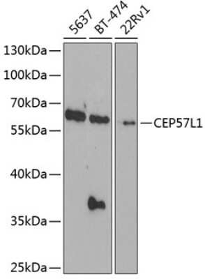 Western Blot: CEP57L1 AntibodyBSA Free [NBP2-92923]