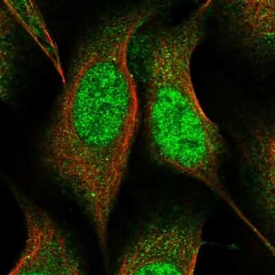 Immunocytochemistry/ Immunofluorescence: CEP70 Antibody [NBP1-88594]