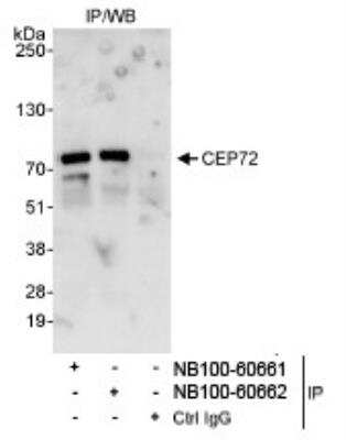 Western Blot: CEP72 Antibody [NB100-60662]