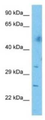 Western Blot: CEP72 Antibody [NBP3-10639]