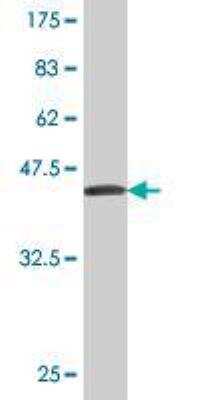 Western Blot: Carboxylesterase 2/CES2 Antibody (4E3) [H00008824-M03]