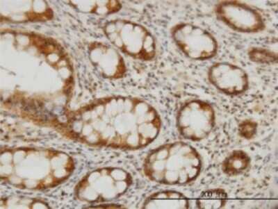 Immunohistochemistry-Paraffin: Carboxylesterase 2/CES2 Antibody (4F12) [H00008824-M02]
