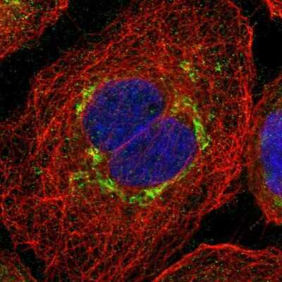 Immunocytochemistry/ Immunofluorescence: Carboxylesterase 2/CES2 Antibody [NBP1-84556]
