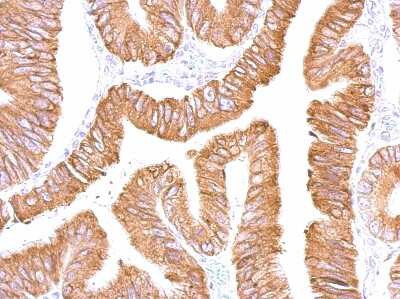Immunohistochemistry-Paraffin: Carboxylesterase 2/CES2 Antibody [NBP1-32653]
