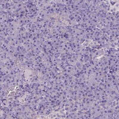 Immunohistochemistry-Paraffin: Carboxylesterase 2/CES2 Antibody [NBP1-84556]
