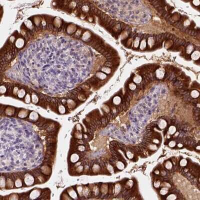 Immunohistochemistry-Paraffin: Carboxylesterase 2/CES2 Antibody [NBP1-84556]