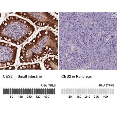 Immunohistochemistry-Paraffin: Carboxylesterase 2/CES2 Antibody [NBP1-84556]
