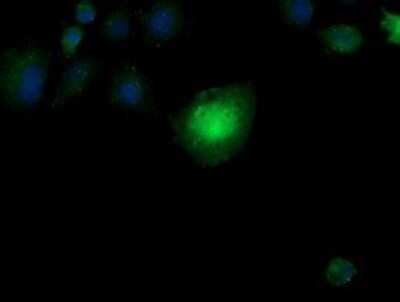 Immunocytochemistry/ Immunofluorescence: CESK1 Antibody (OTI1C1) - Azide and BSA Free [NBP2-72414]