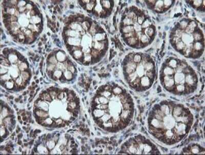 Immunohistochemistry: CESK1 Antibody (OTI1C1) [NBP2-46114]