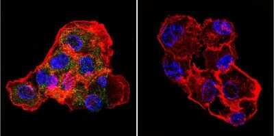 Immunocytochemistry/ Immunofluorescence: CETP Antibody (ATM192) - BSA Free [NB300-558]