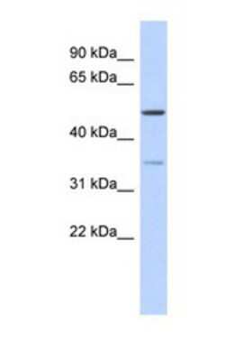 Western Blot: CETP Antibody [NBP1-57982]