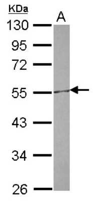 Western Blot: CETP Antibody [NBP2-15867]