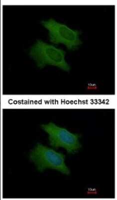 Immunocytochemistry/ Immunofluorescence: Complement Factor H-related 1/CFHR1/CFHL1 Antibody [NBP2-15868]
