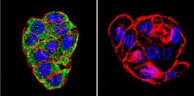 Immunocytochemistry/ Immunofluorescence: CFTR Antibody (CF3) [NB300-511]