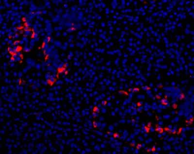Immunocytochemistry/ Immunofluorescence: CFTR Antibody (CF3) [NB300-511]