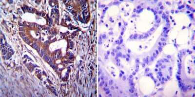 Immunohistochemistry-Paraffin: CFTR Antibody (CF3) [NB300-511]