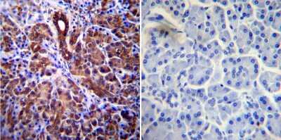 Immunohistochemistry-Paraffin: CFTR Antibody (CF3) [NB300-511]